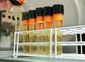 Análisis de orina en la clínica veterinaria 2 analisis orina