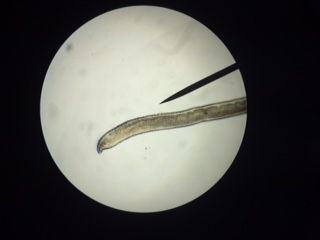 gusano ojo